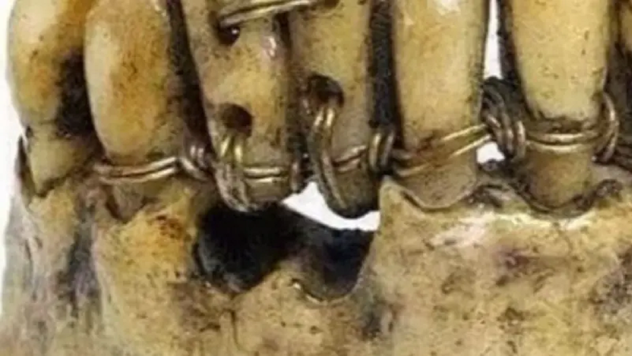 مصر باستان ارتودنسی دندان