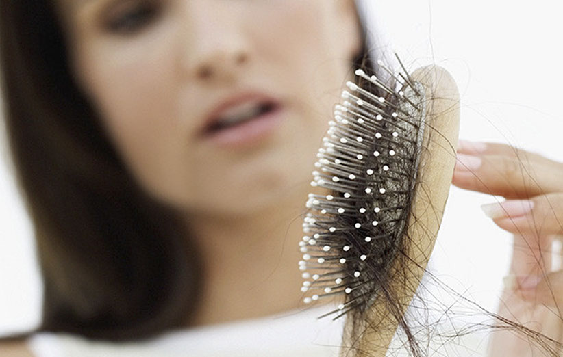 درمان ریزش مو با این راهکارها